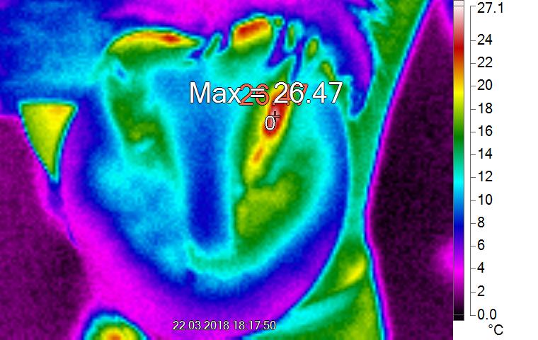 Wärmebild eines Hufes von unten - Verdacht: Hufabszess